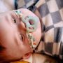 Baby with feeding tube laying down with ultralight pacifier in their mouth