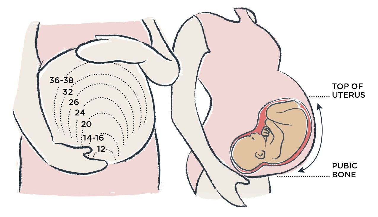 illustration of what fundal height tracking is